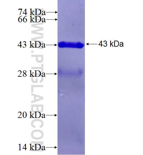 TGM7 fusion protein Ag26875 SDS-PAGE