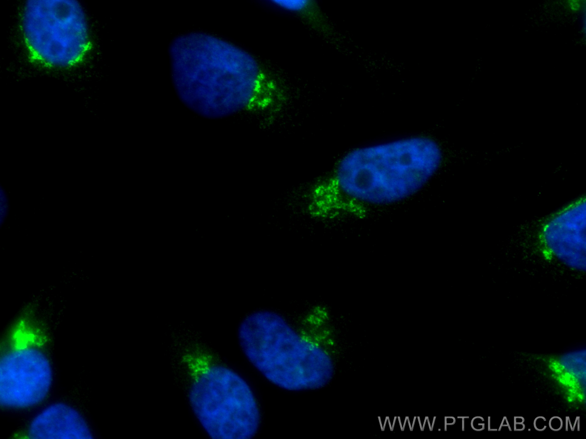 IF Staining of HeLa using CL488-13573