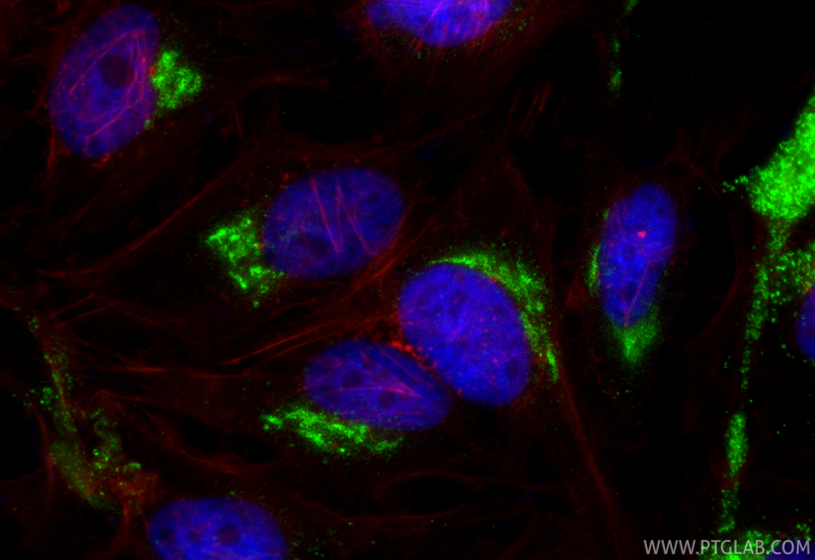 IF Staining of HeLa using RMX00075 IF Staining of HeLa using RMX00075
