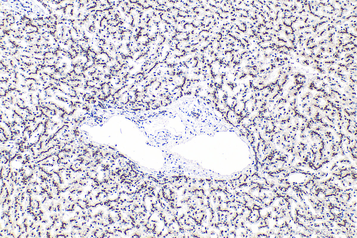 IHC staining of human liver using RMX00075 IHC staining of human liver using RMX00075