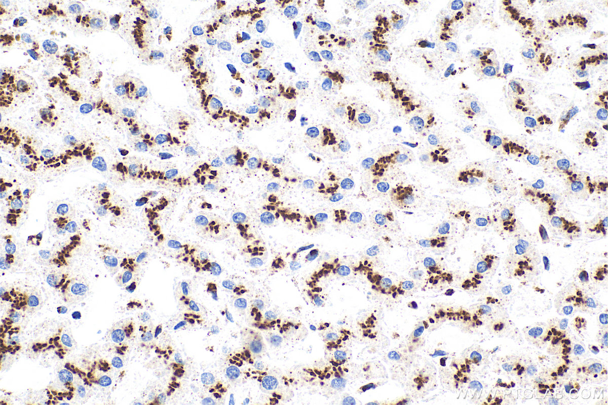 IHC staining of human liver using RMX00075 IHC staining of human liver using RMX00075