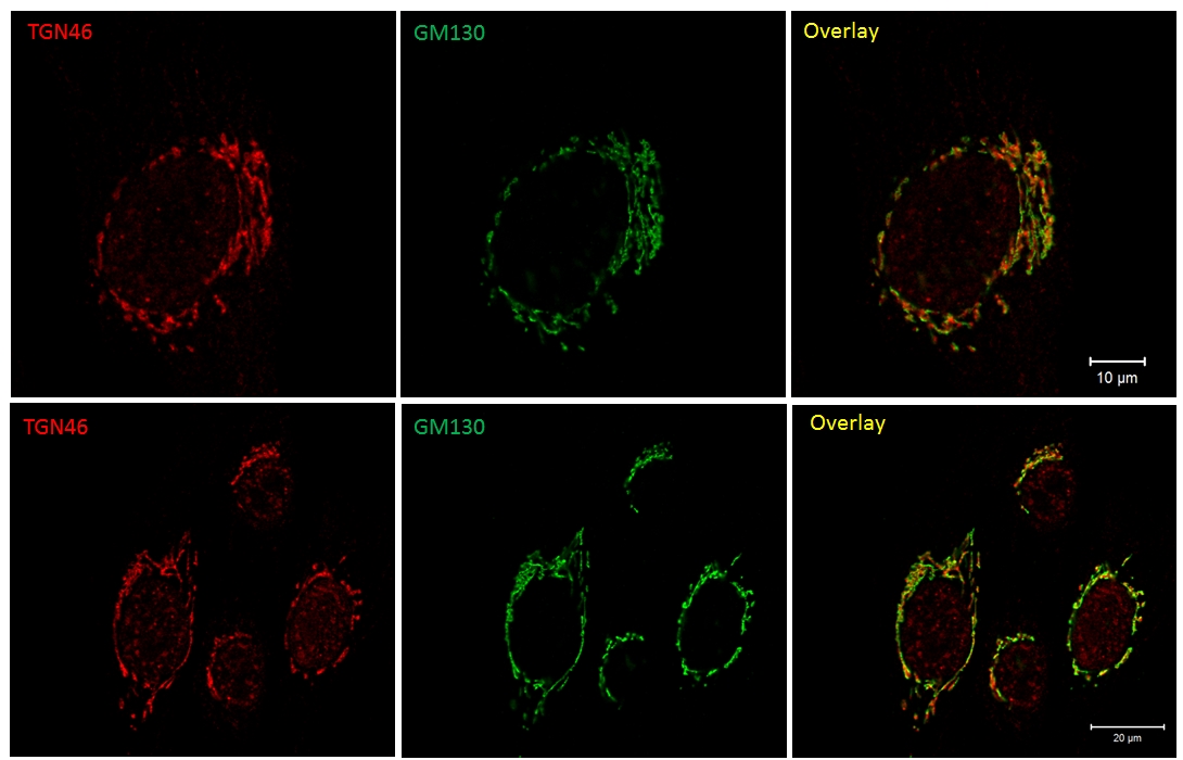 IF Staining of Fibroblast (primary cells) using 13573-1-AP