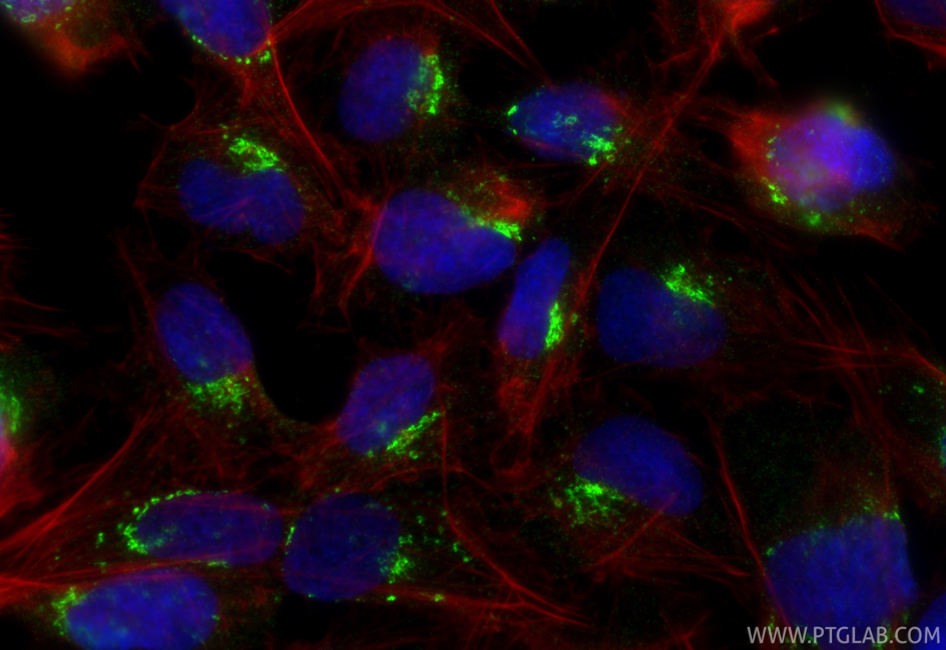 IF Staining of U2OS using 13573-1-AP IF Staining of U2OS using 13573-1-AP