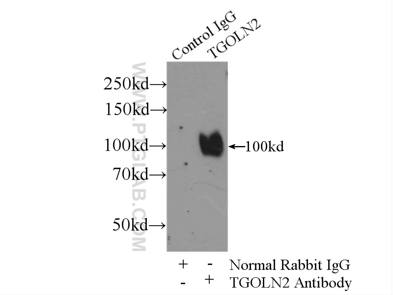 IP experiment of HeLa using 13573-1-AP