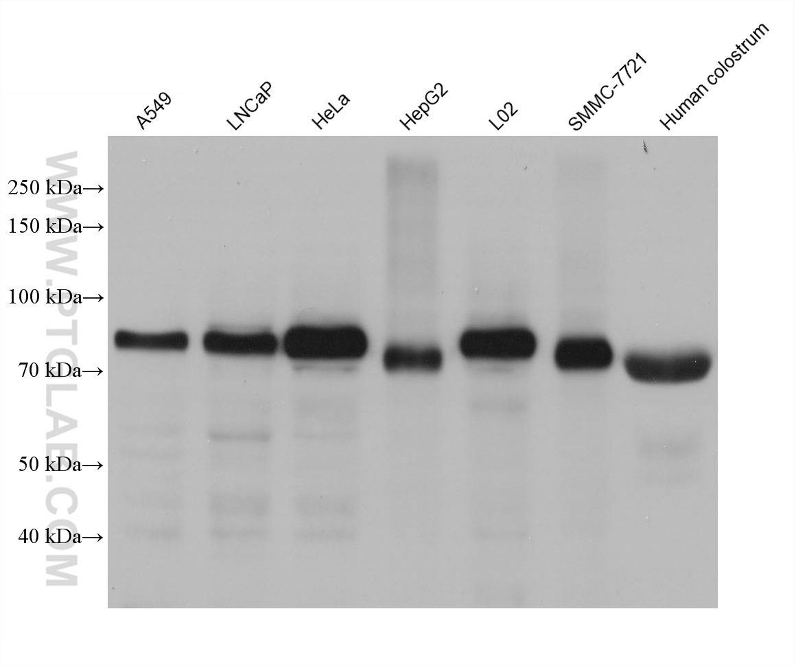 WB analysis using 66477-1-Ig