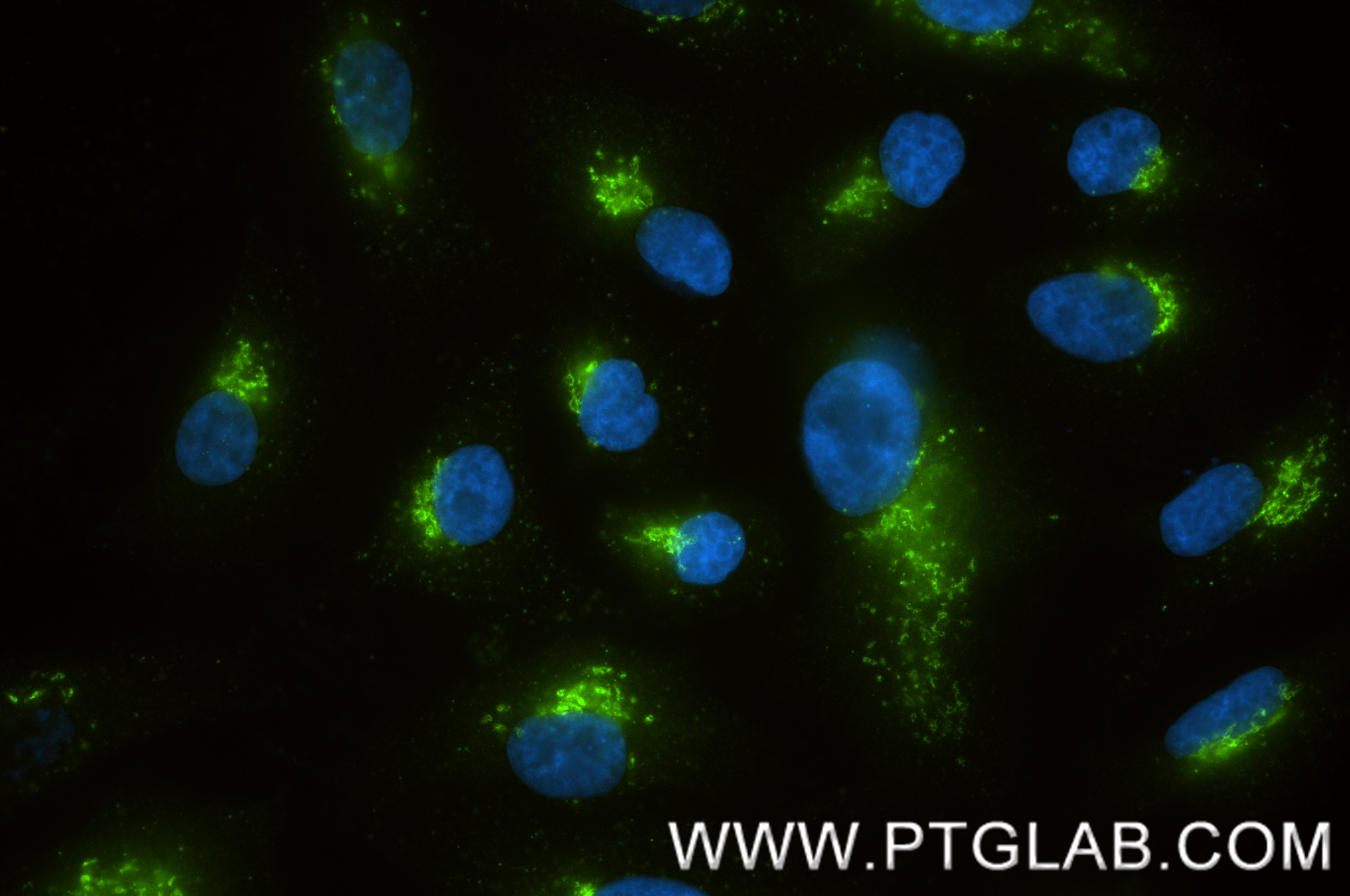 Immunofluorescent analysis of (4% PFA) fixed A549 cells using TGN46 antibody (83099-2-RR, Clone: 230376D6 ) at dilution of 1:400 and CoraLite®488-Conjugated Goat Anti-Rabbit IgG(H+L) (<a class='green' href='/productredirect?CatalogNo=SA00013-2' target='_blank'>SA00013-2</a>). IF Staining of A549 using 83099-2-RR