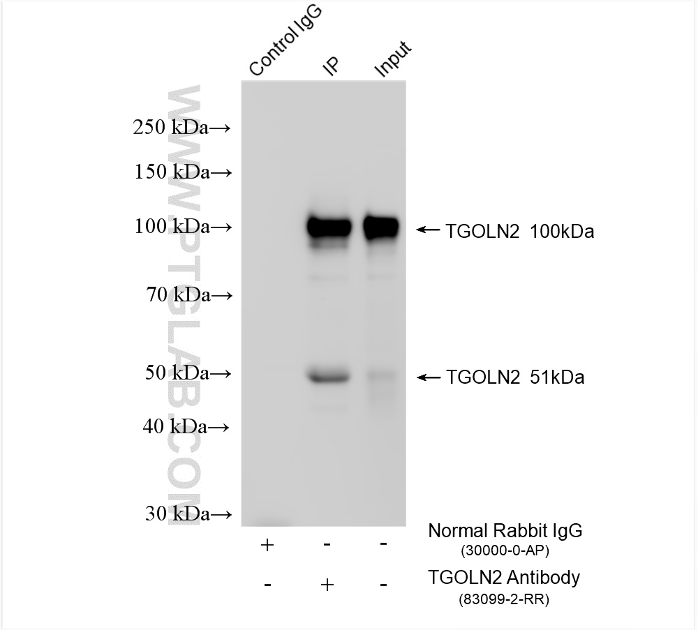 IP experiment of HeLa using 83099-2-RR