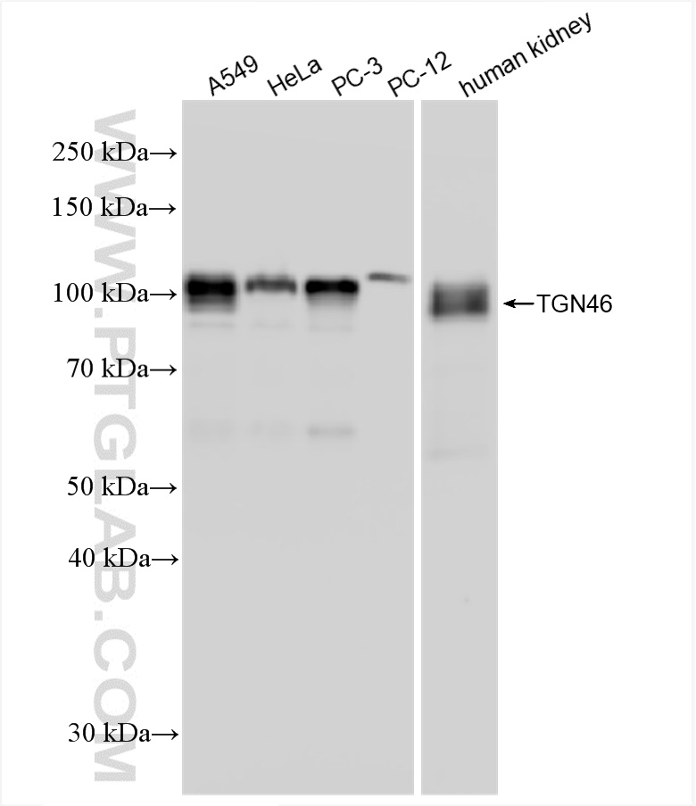 WB analysis using 83099-2-RR (same clone as 83099-2-PBS)