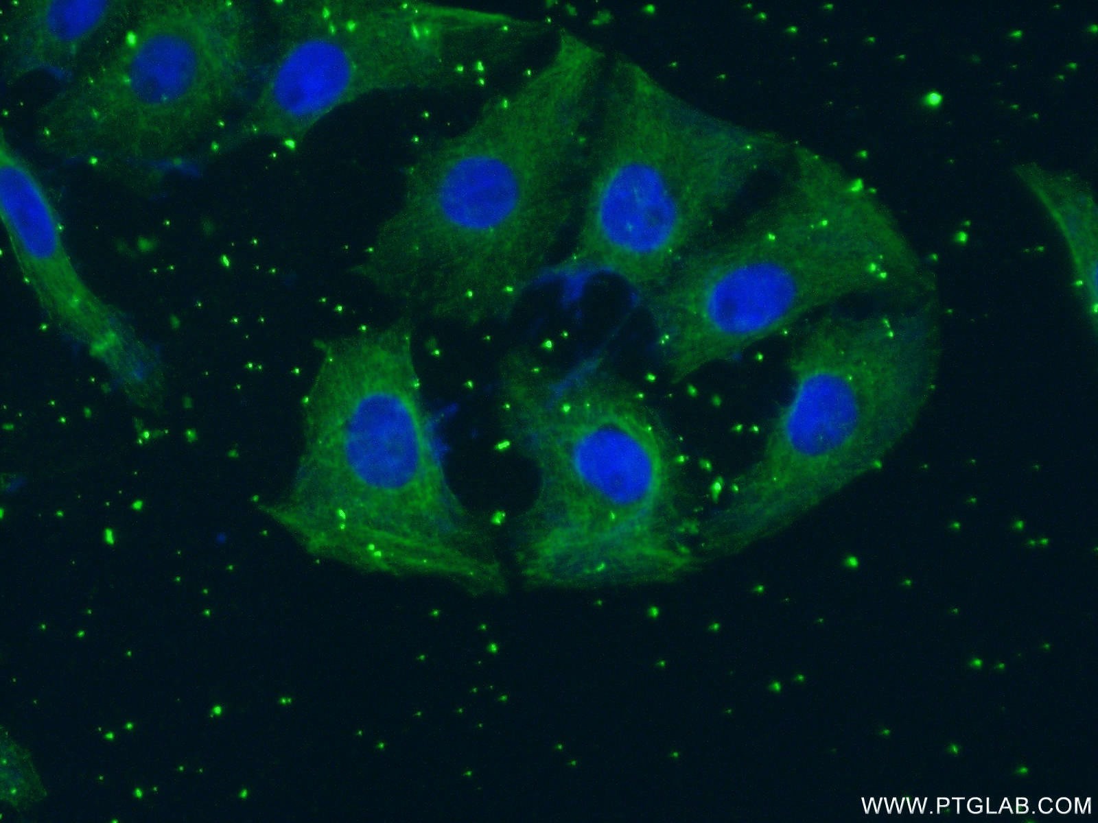 IF Staining of SH-SY5Y using 66334-1-Ig (same clone as 66334-1-PBS)