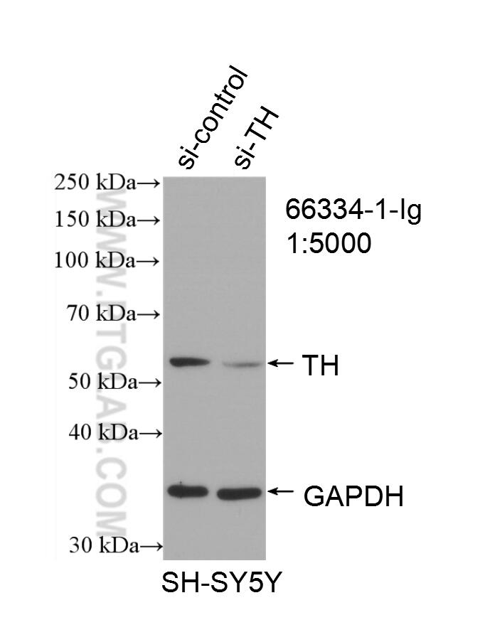 WB analysis of SH-SY5Y using 66334-1-Ig