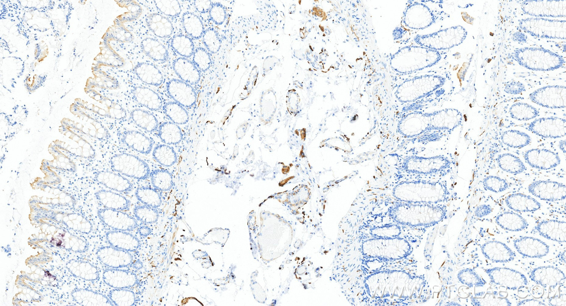 IHC staining of human colon using 85929-5-RR