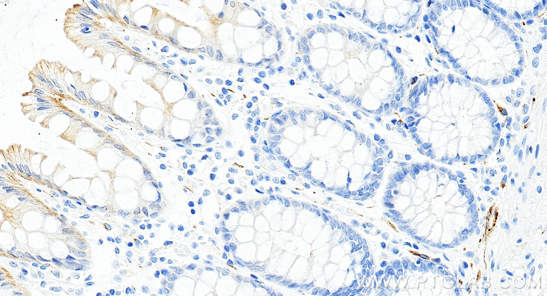 IHC staining of human colon using 85929-5-RR
