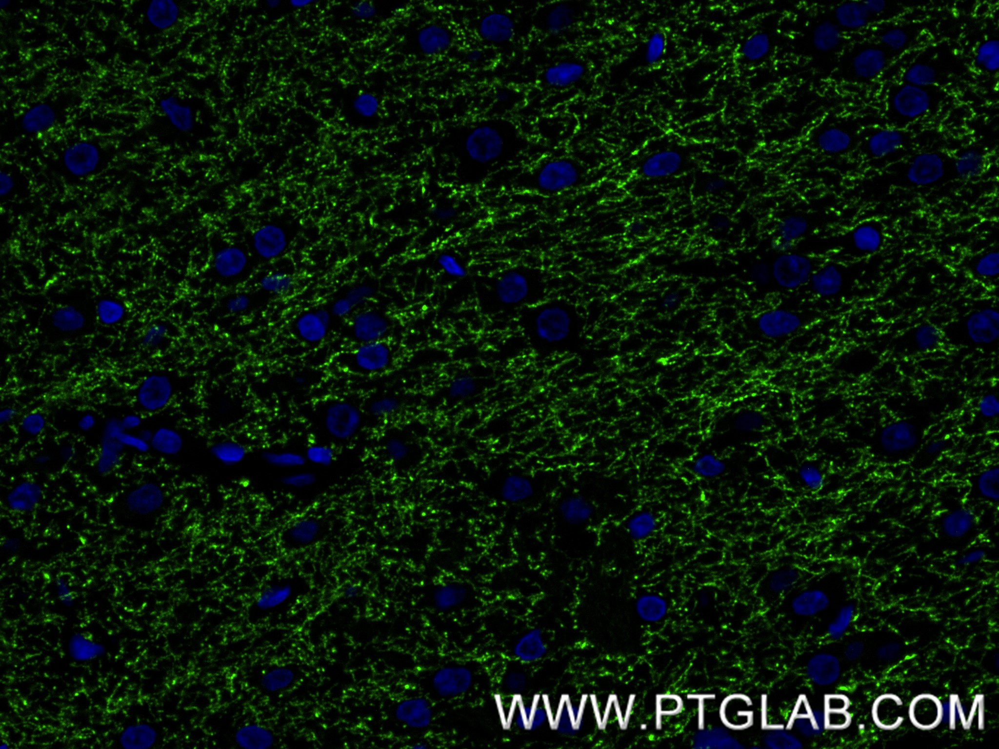 IF Staining of rat brain using 85929-5-RR