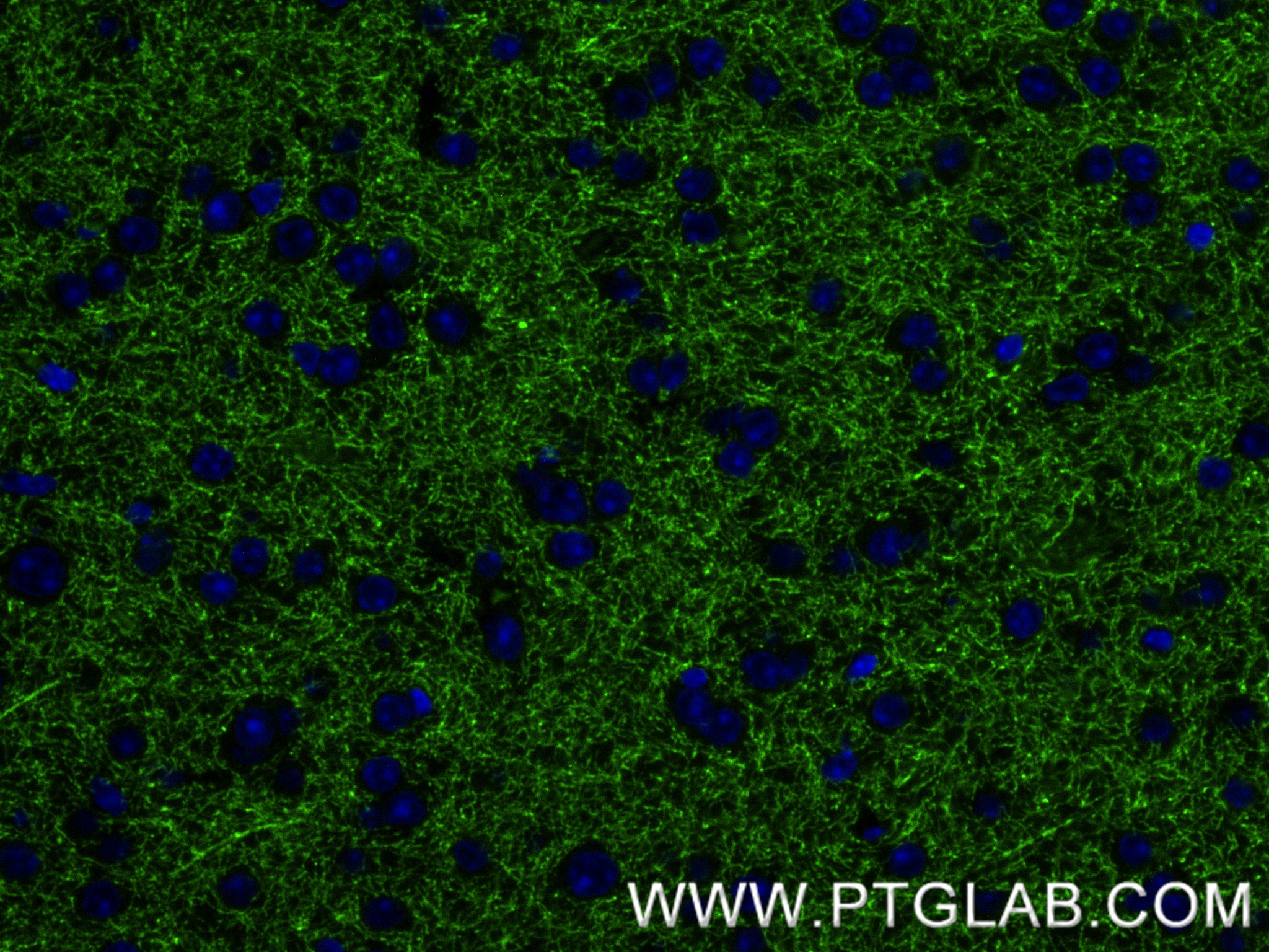 IF Staining of mouse brain using 85929-5-RR