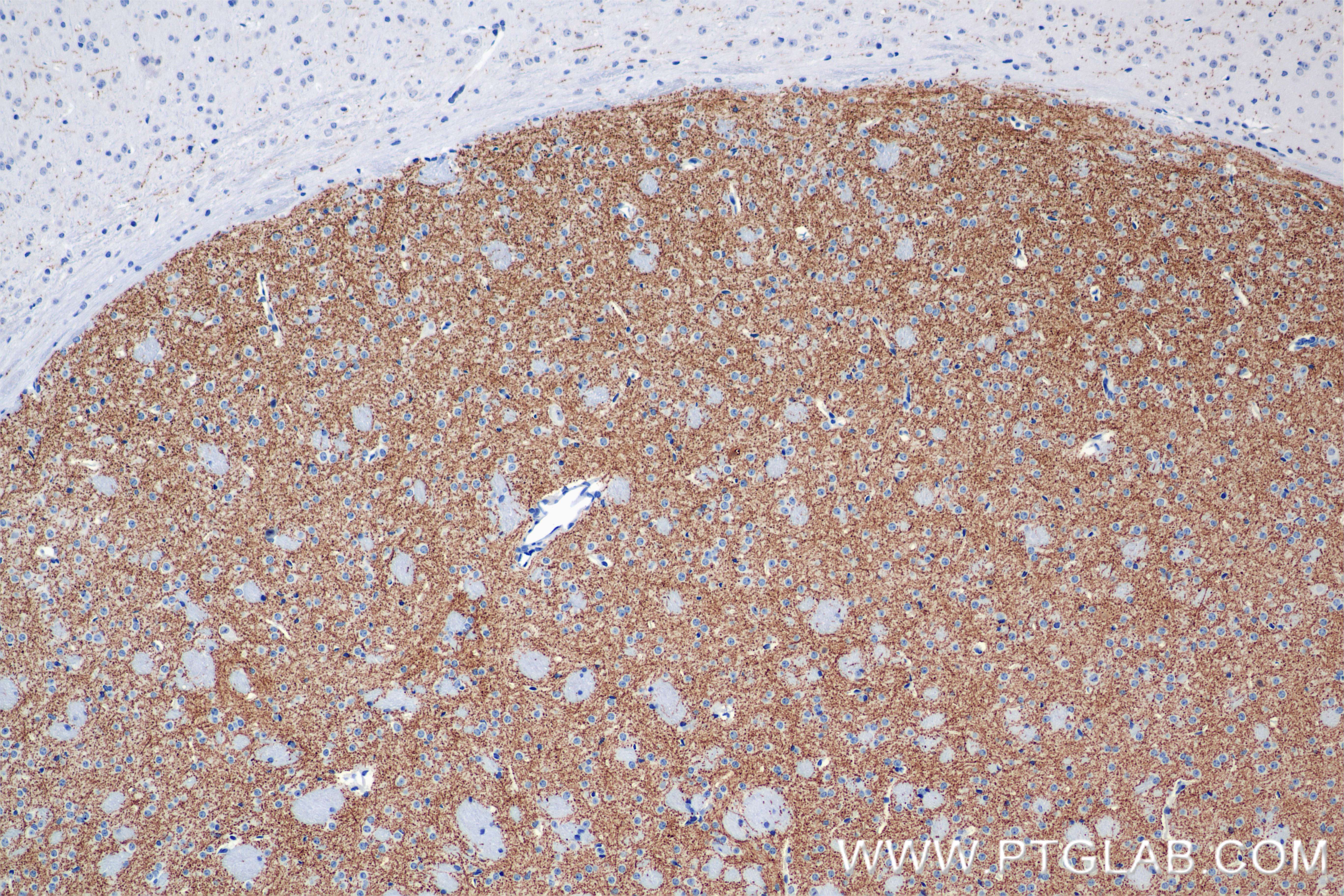 IHC staining of mouse brain using 85929-5-RR