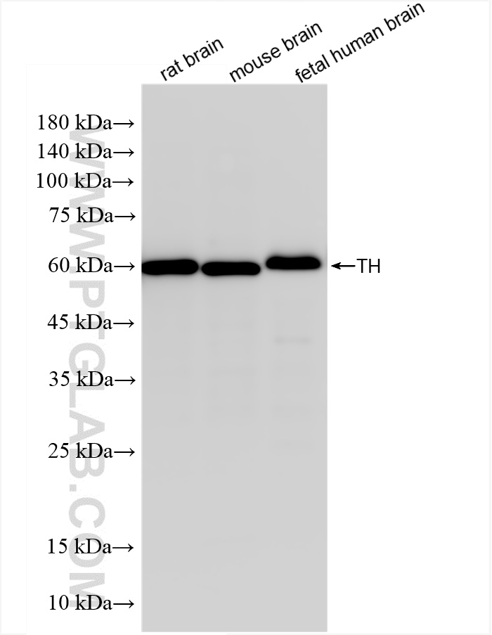 WB analysis using 85929-5-RR