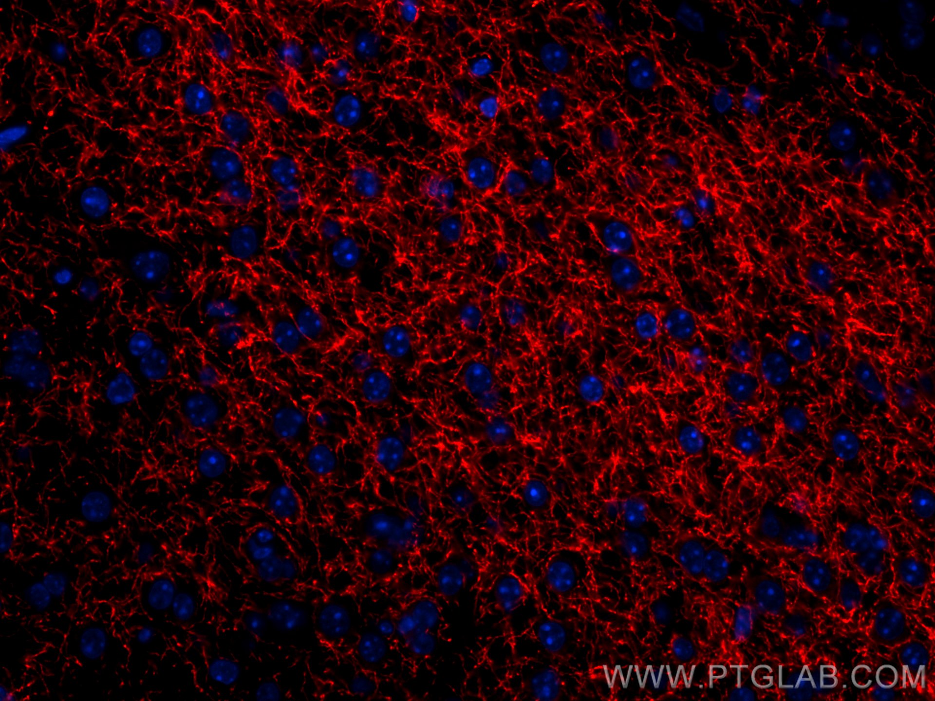 IF Staining of mouse brain using CL594-25859