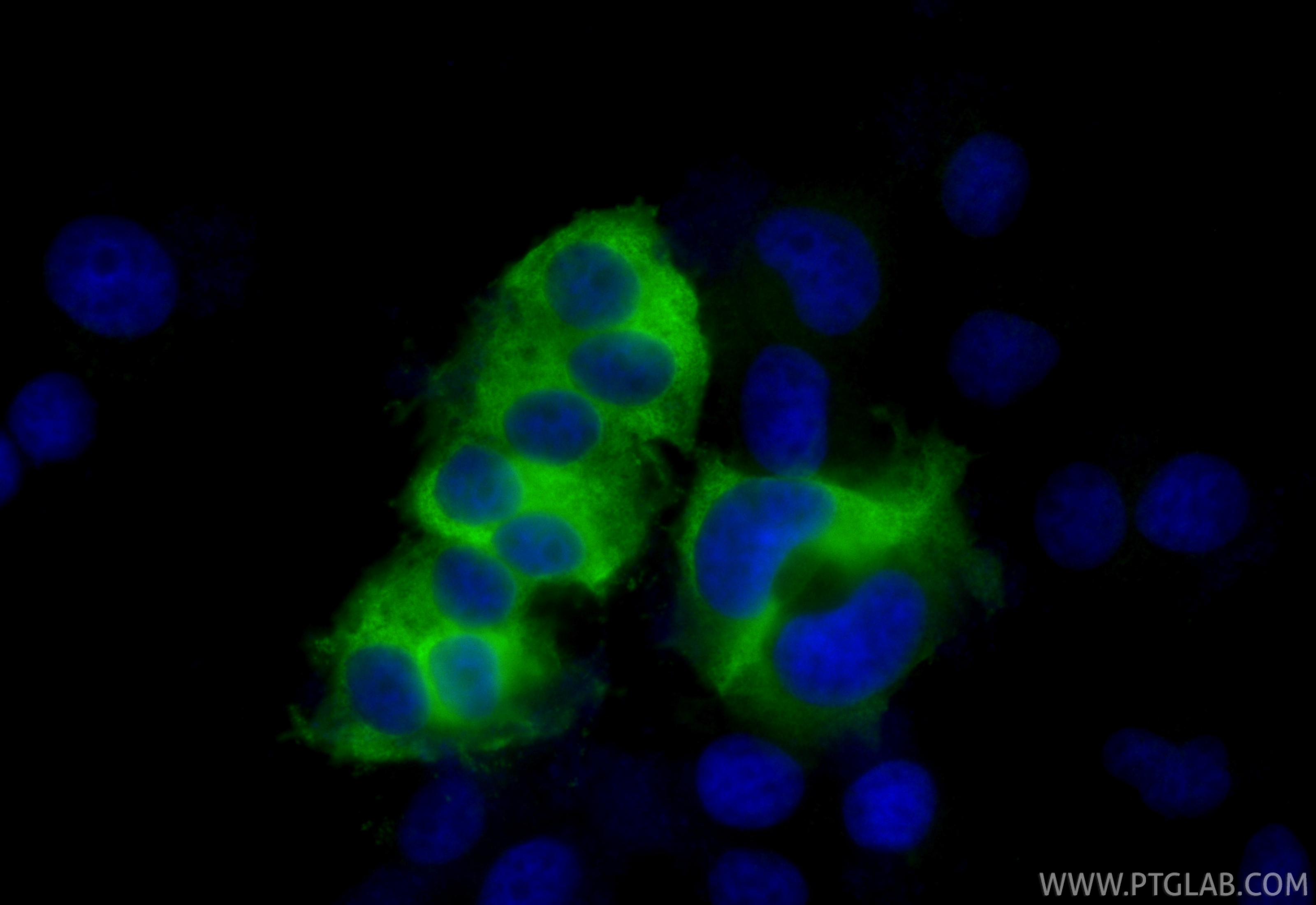 IF Staining of PC-12 using RMX00053