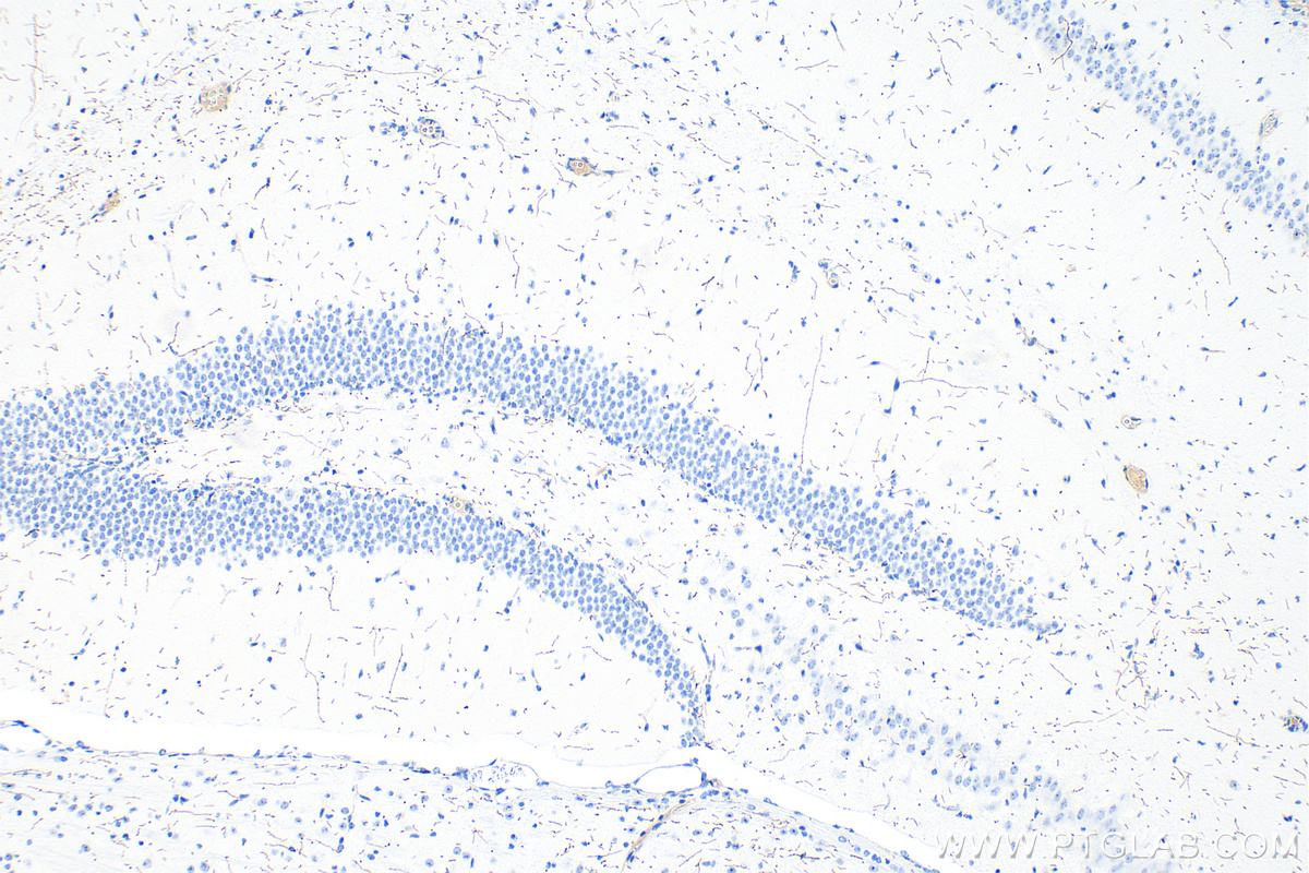 IHC staining of mouse brain using RMX00053
