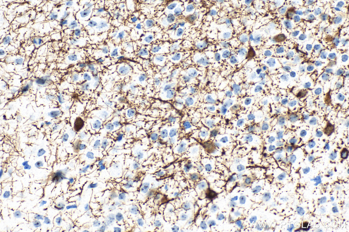 IHC staining of mouse brain using RMX00053