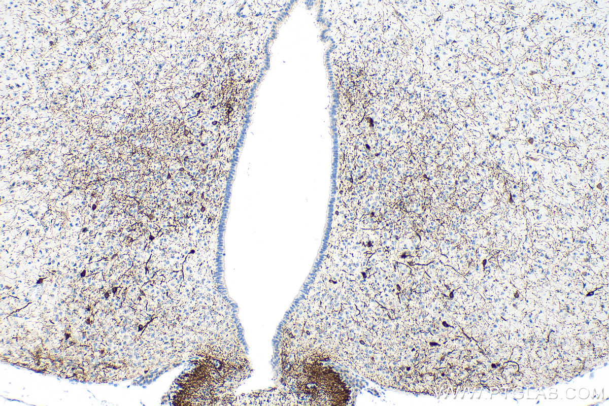 IHC staining of mouse brain using RMX00053