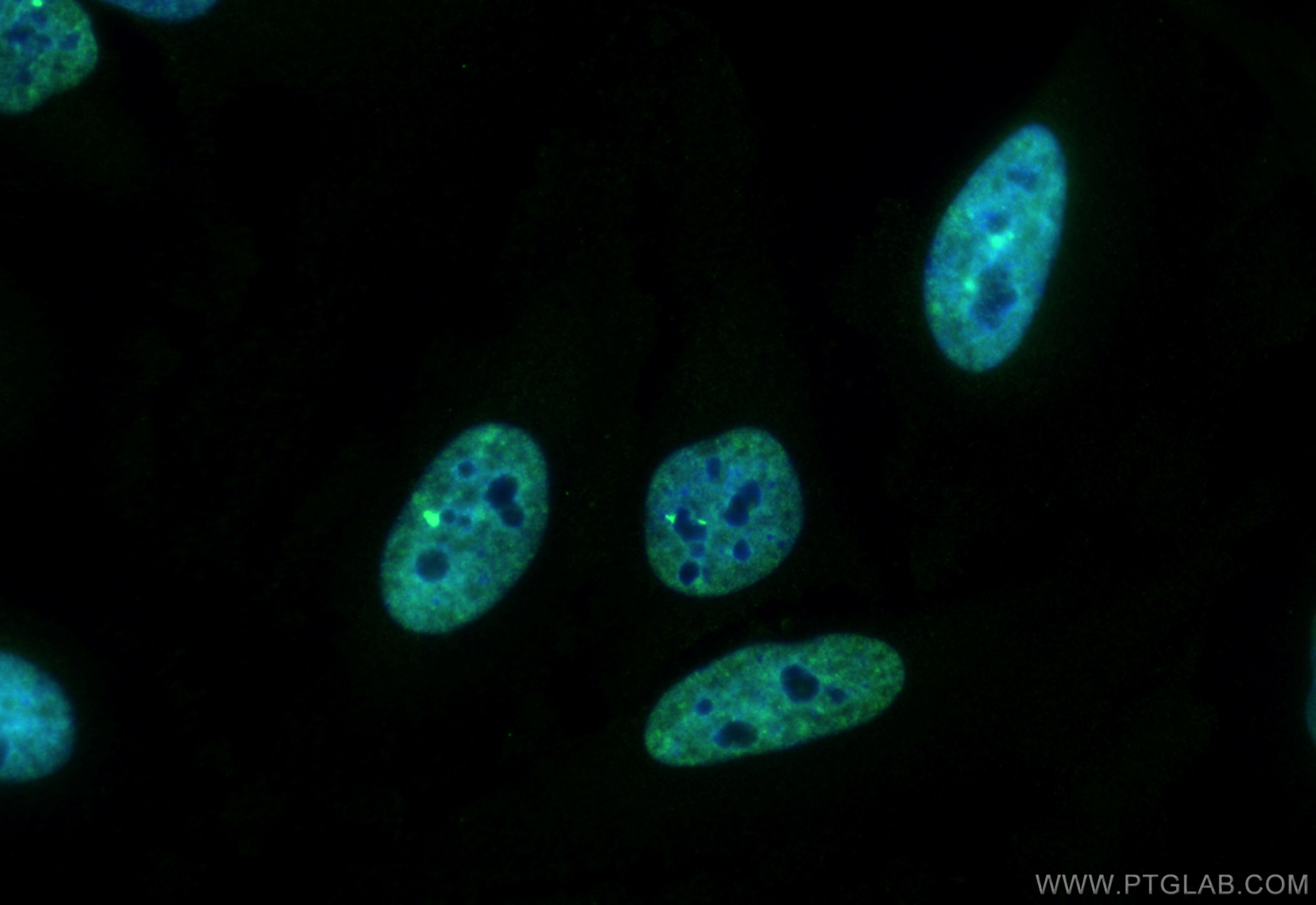 Immunofluorescent analysis of (4% PFA) fixed HeLa cells using CoraLite® Plus 488 TH1L antibody (CL488-67380, Clone: 1A10G2 ) at dilution of 1:200. IF Staining of HeLa using CL488-67380