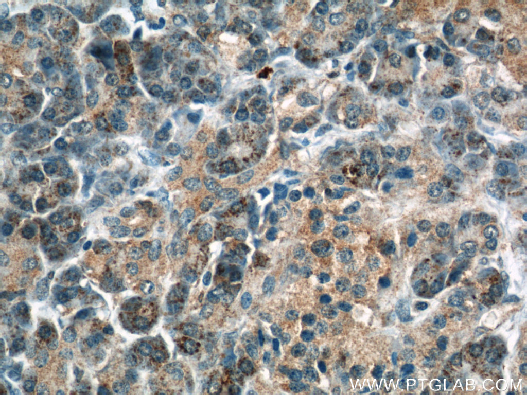 IHC staining of human pancreas using 12909-1-AP