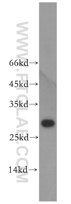 WB analysis of HepG2 using 12584-1-AP