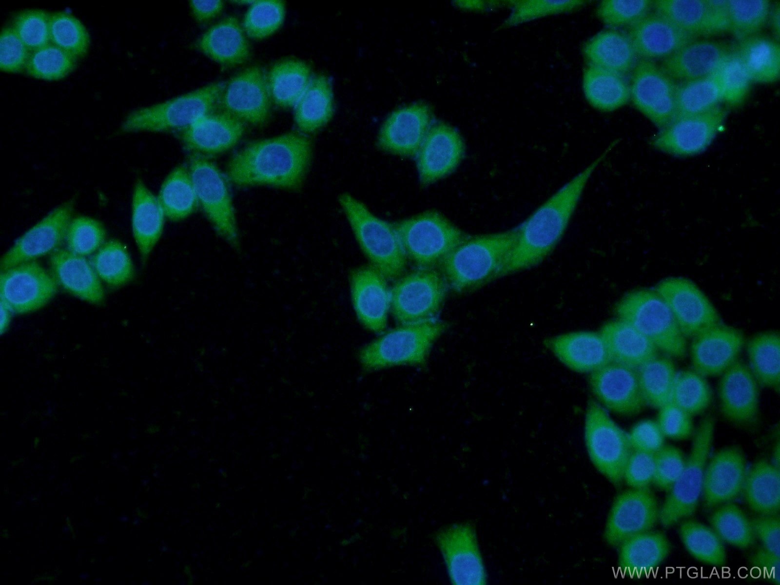 IF Staining of HeLa using 21897-1-AP