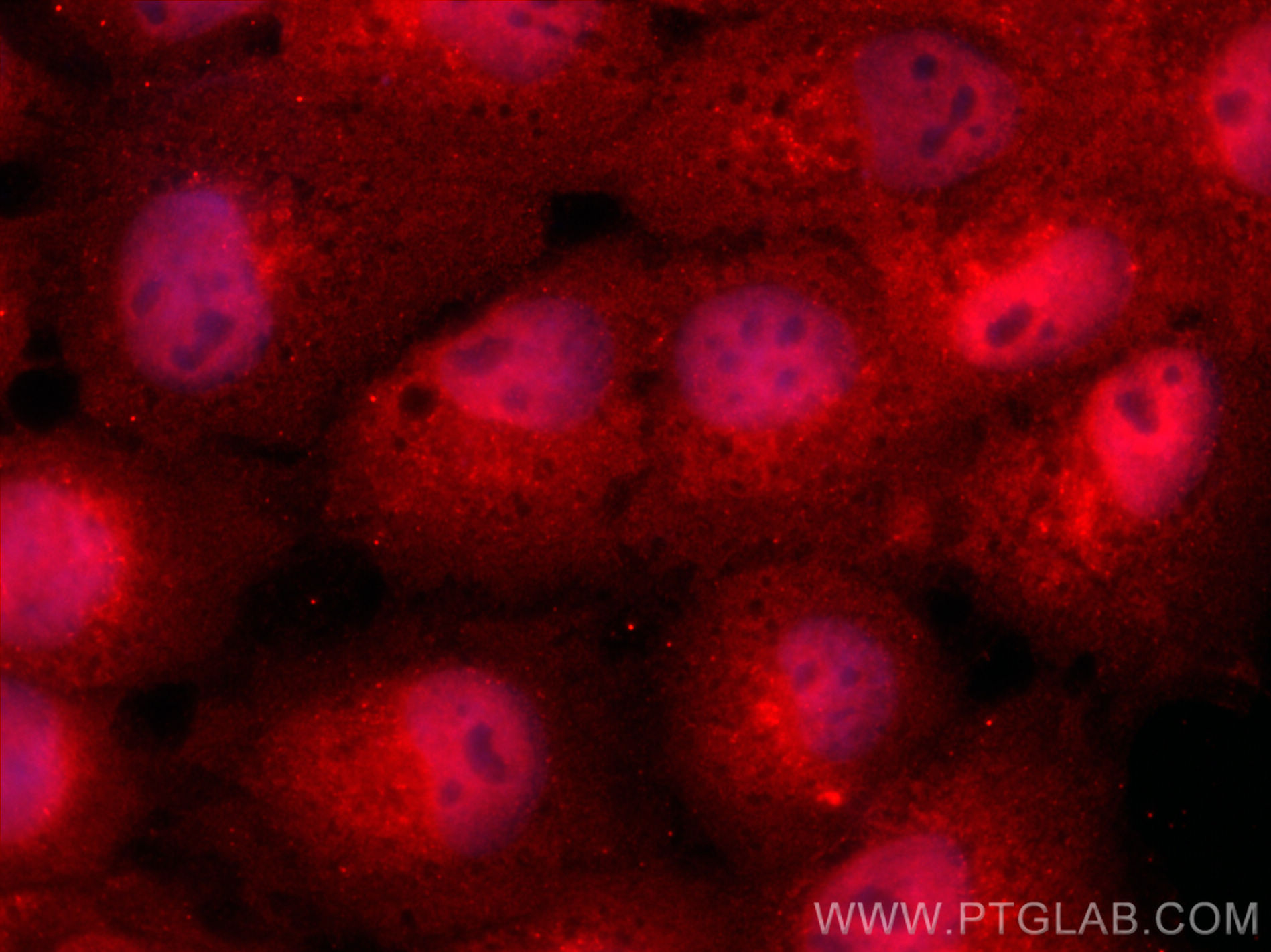 Immunofluorescent analysis of (4% PFA) fixed A431 cells using THAP10 antibody (21897-1-AP) at dilution of 1:400 and CoraLite®594-Conjugated Goat Anti-Rabbit IgG(H+L) (<a class='green' href='/productredirect?CatalogNo=SA00013-4' target='_blank'>SA00013-4</a>). IF Staining of A431 using 21897-1-AP