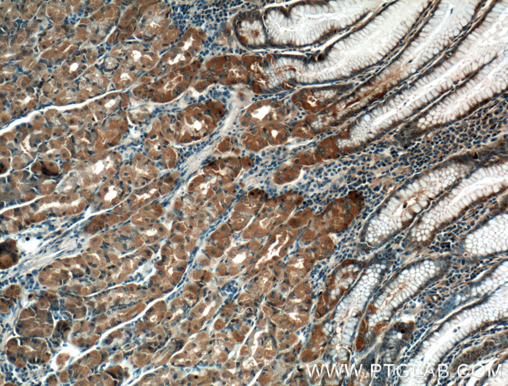 IHC staining of human stomach using 21897-1-AP