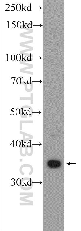 WB analysis of HeLa using 21897-1-AP