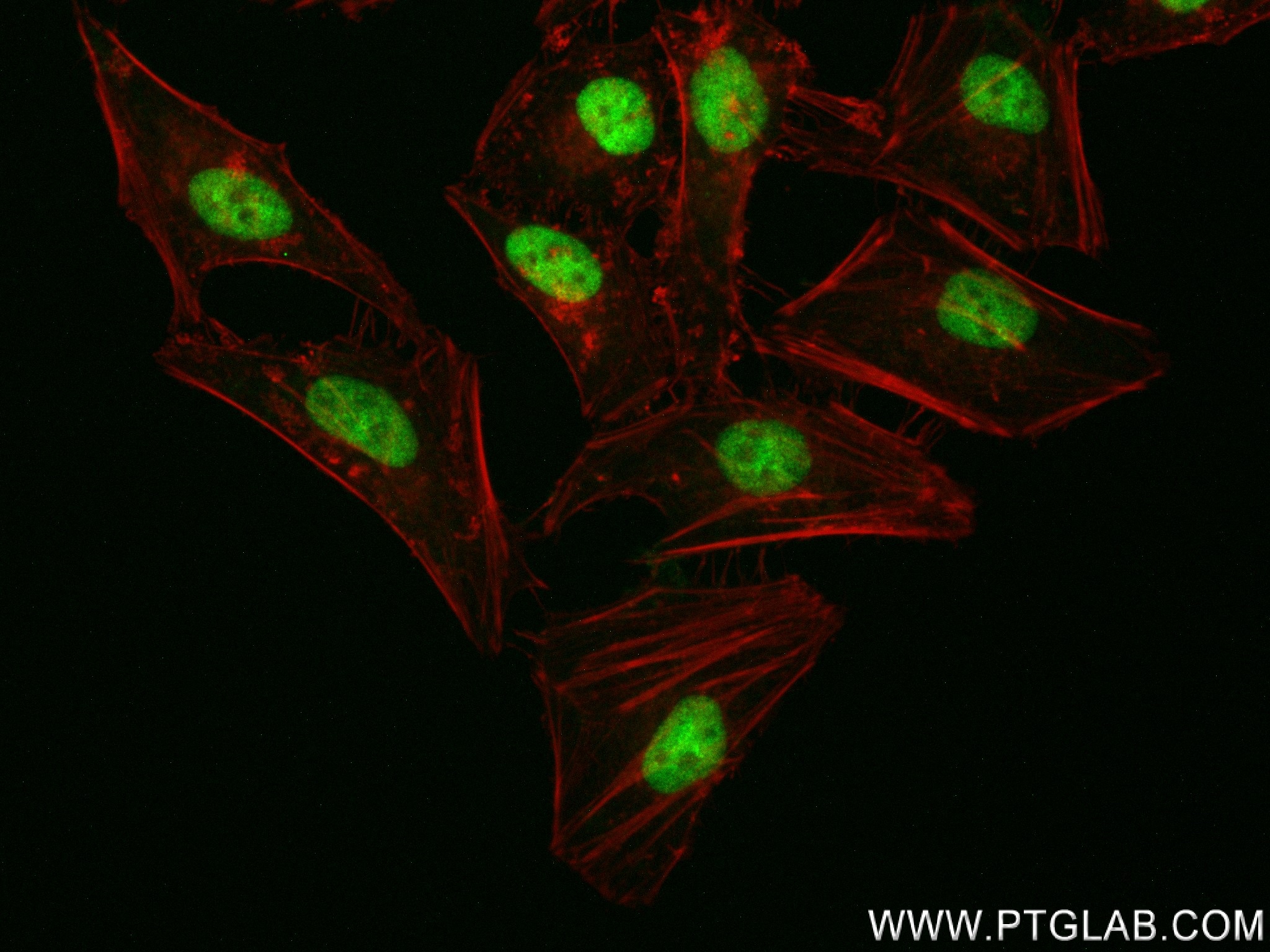 IF Staining of HeLa using 84373-6-RR (same clone as 84373-6-PBS)
