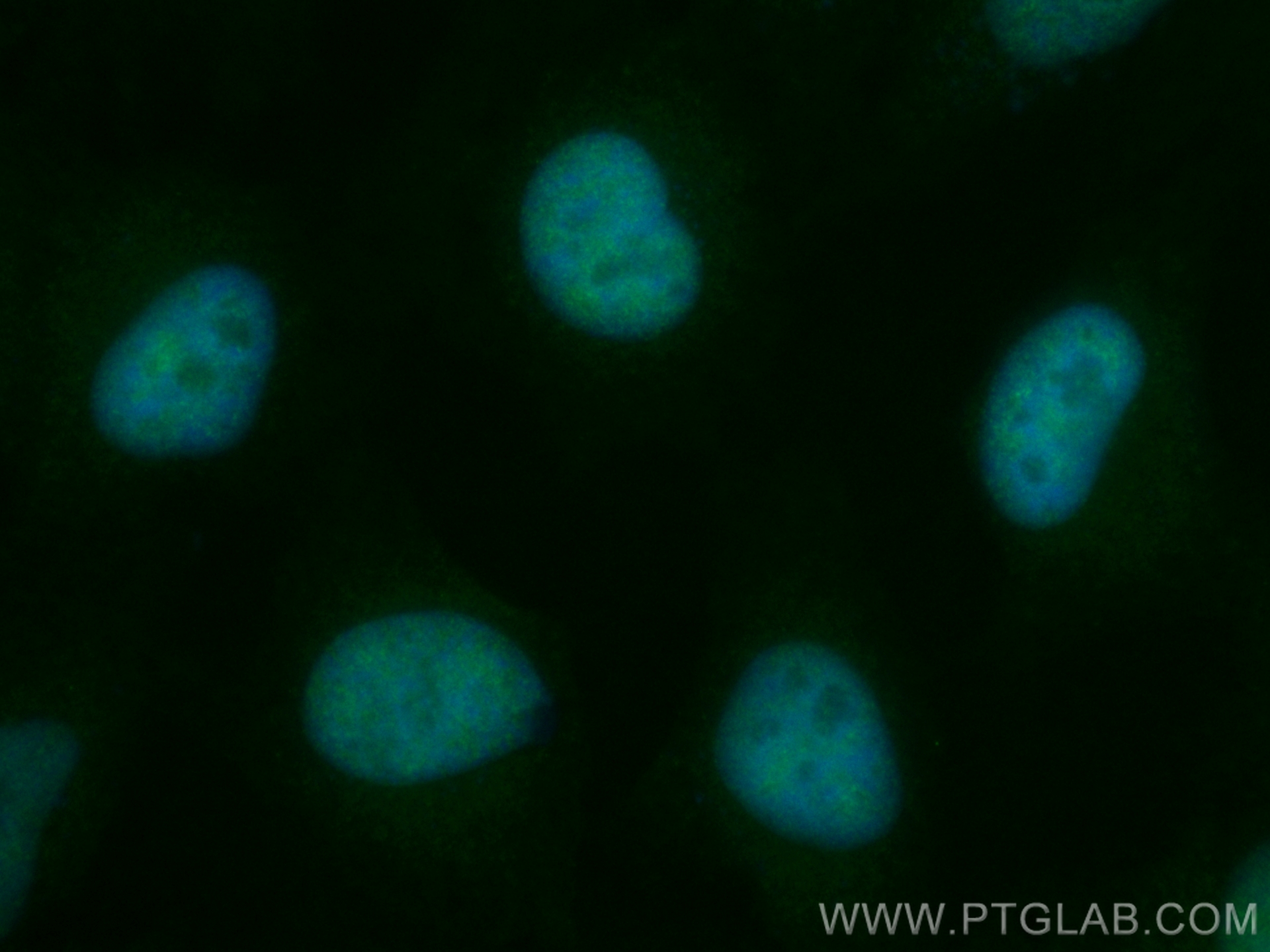 IF Staining of HeLa using CL488-84373-6
