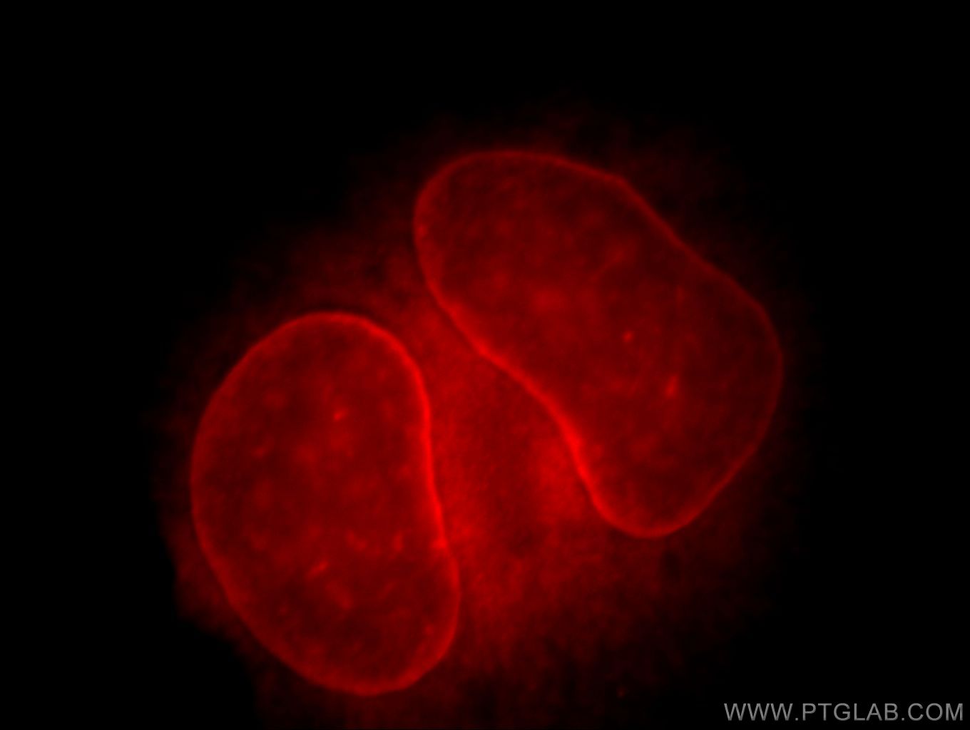 IF Staining of HeLa using 20853-1-AP