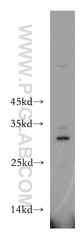 WB analysis of HEK-293 using 20853-1-AP