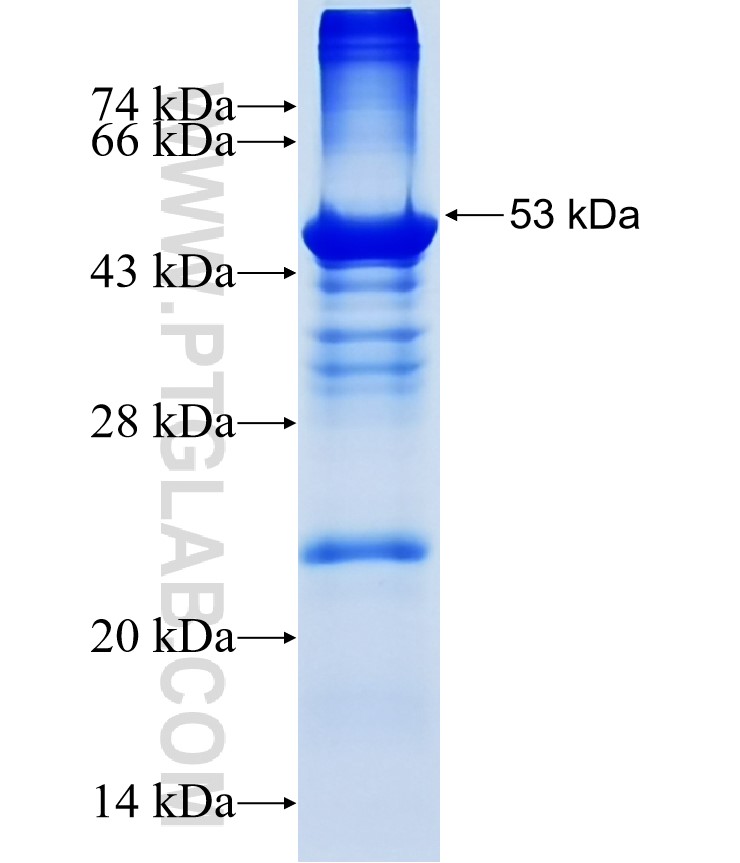 THAP6 fusion protein Ag14934 SDS-PAGE THAP6 fusion protein Ag14934 SDS-PAGE