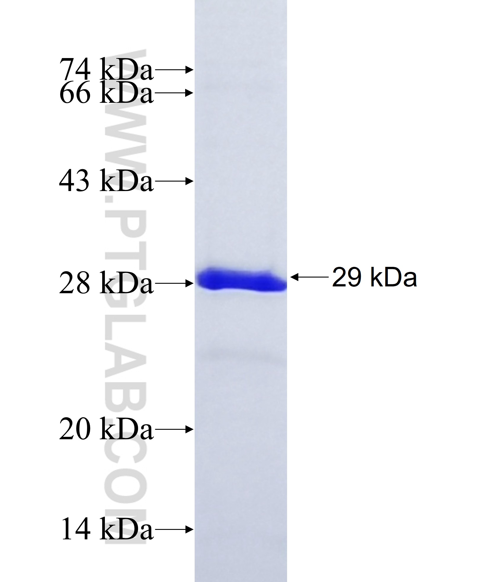 THAP8 fusion protein Ag36866 SDS-PAGE THAP8 fusion protein Ag36866 SDS-PAGE