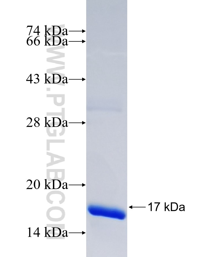 THAP9 fusion protein Ag37249 SDS-PAGE THAP9 fusion protein Ag37249 SDS-PAGE