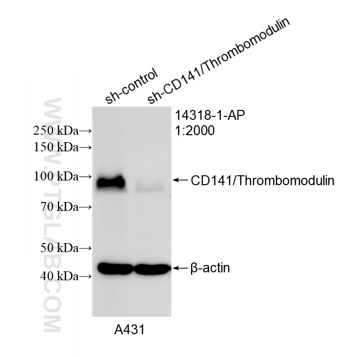 WB result of CD141/Thrombomodulin antibody (14318-1-AP; 1:2000; incubated at room temperature for 1.5 hours) with sh-Control and sh-CD141/Thrombomodulin transfected A431 cells. WB analysis of A431 using 14318-1-AP