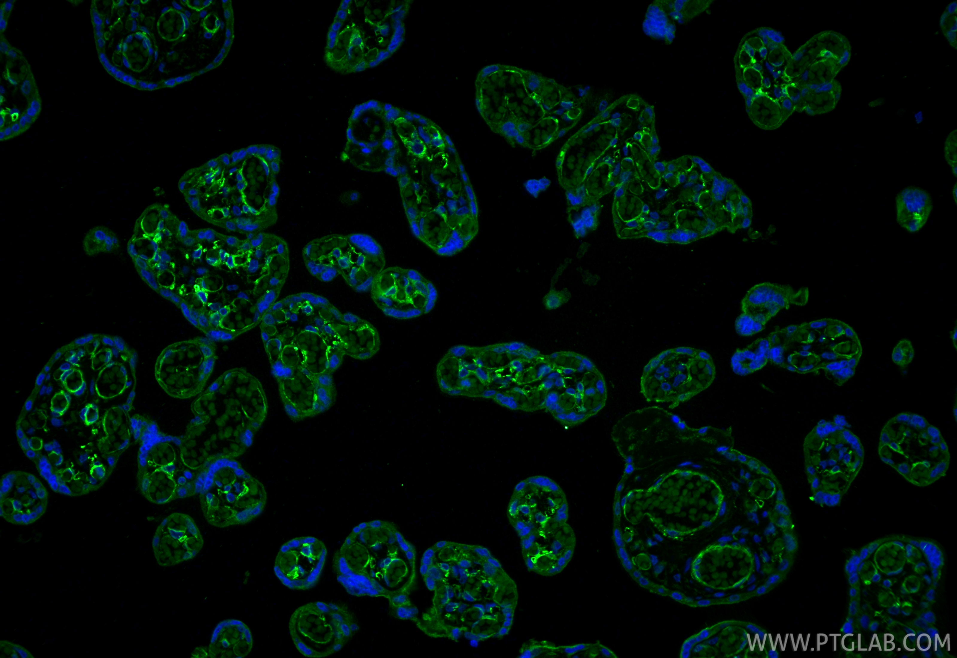 IF Staining of human placenta using 67831-1-Ig IF Staining of human placenta using 67831-1-Ig