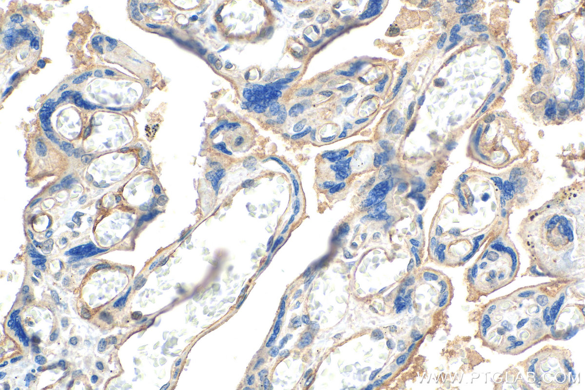 CD141/Thrombomodulin