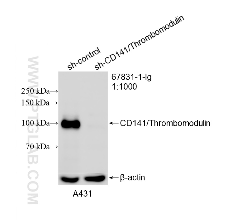 WB result of CD141/Thrombomodulin antibody (67831-1-Ig; 1:1000; incubated at room temperature for 1.5 hours) with sh-Control and sh-CD141/Thrombomodulin transfected A431 cells. WB analysis of A431 using 67831-1-Ig