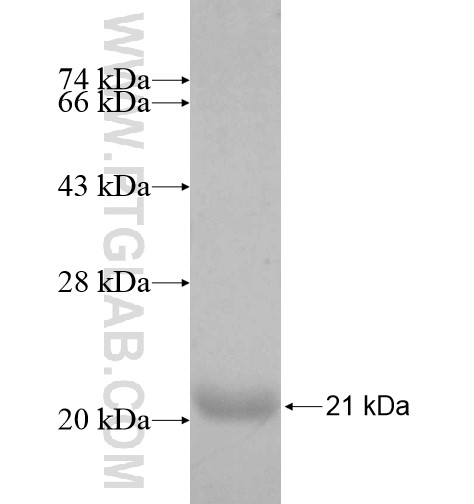 THEM2 fusion protein Ag10244 SDS-PAGE THEM2 fusion protein Ag10244 SDS-PAGE