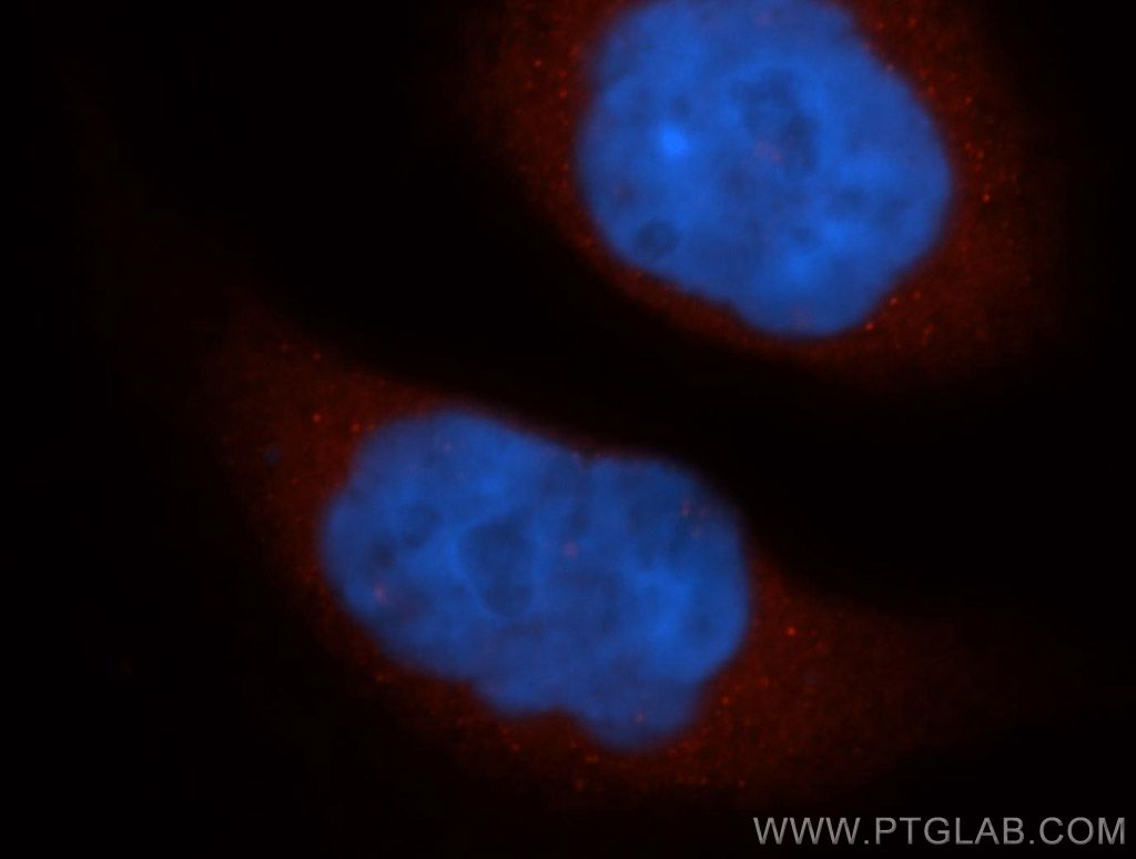 IF Staining of HeLa using 14692-1-AP