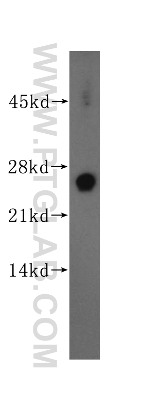 WB analysis of mouse brain using 14692-1-AP