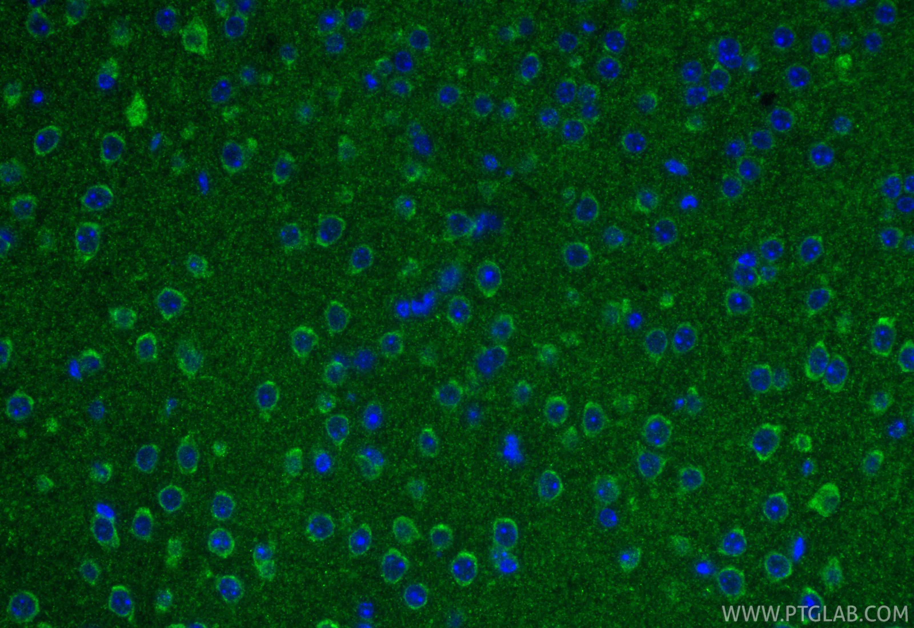 IF Staining of mouse brain using 15208-1-AP IF Staining of mouse brain using 15208-1-AP