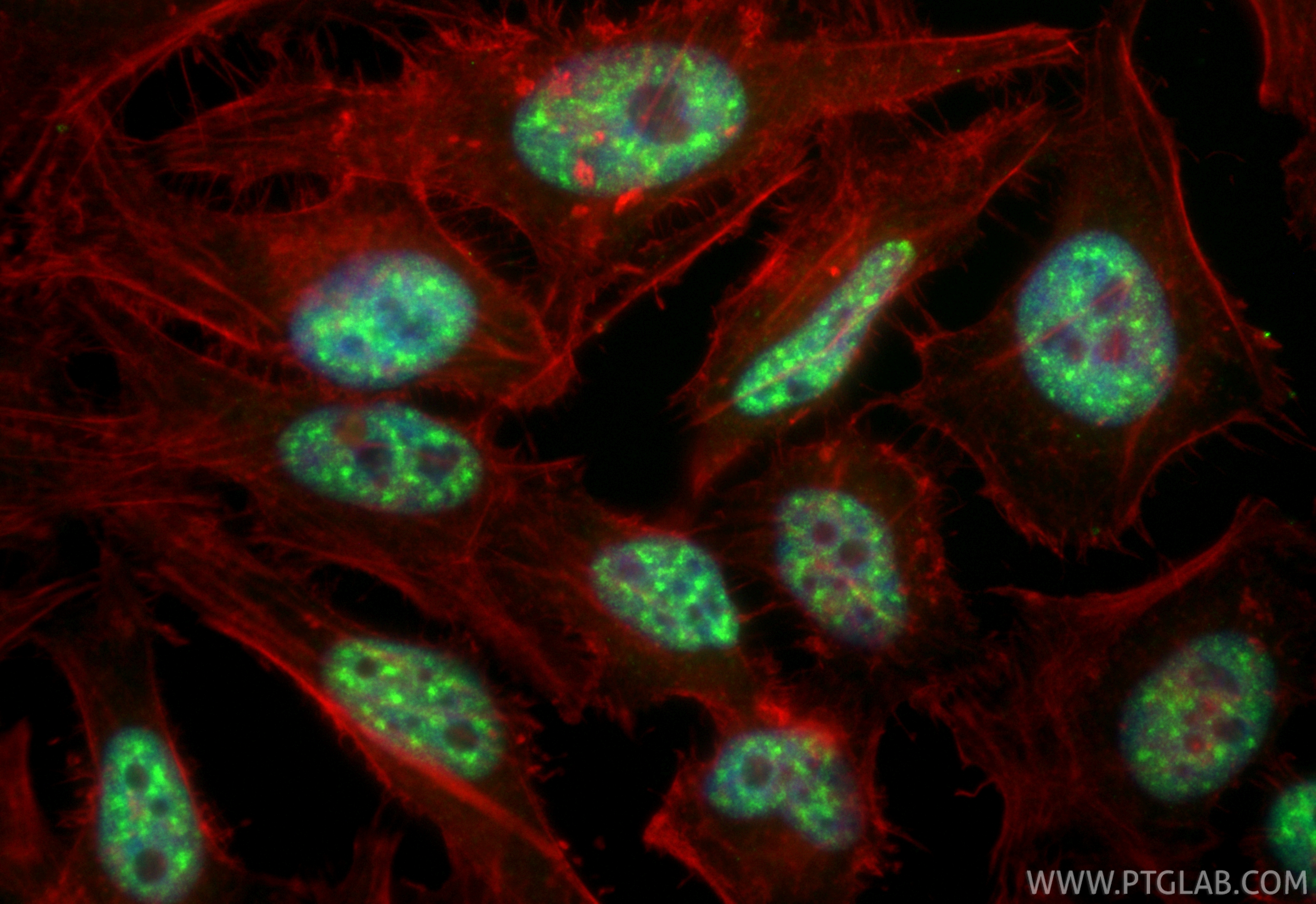 Immunofluorescent analysis of (4% PFA) fixed HeLa cells using CoraLite® Plus 488 THOC1 antibody (CL488-85642-5, Clone: 243161E9 ) at dilution of 1:200, CL594-Phalloidin (red). IF Staining of HeLa using CL488-85642-5
