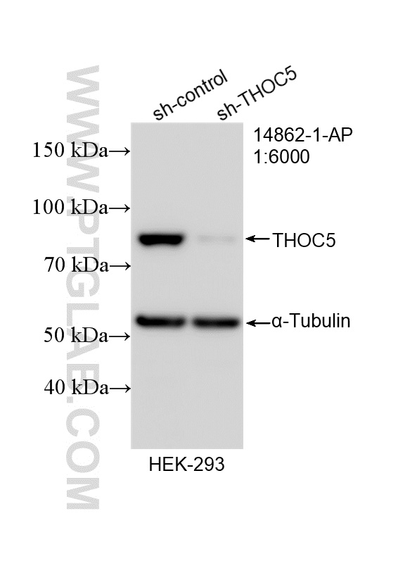 WB result of THOC5 antibody (14862-1-AP; 1:6000; incubated at room temperature for 1.5 hours) with sh-Control and sh-THOC5 transfected HEK-293 cells. WB analysis of HEK-293 using 14862-1-AP