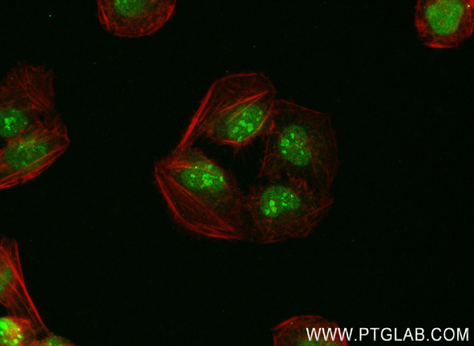 IF Staining of U2OS using 83435-1-RR (same clone as 83435-1-PBS)